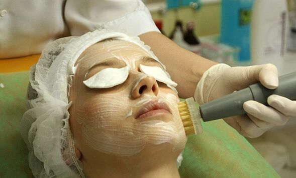 Brocheo facial